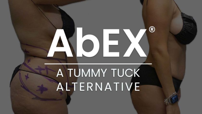 Tummy Tuck Surgery: Cost, Reviews, Before & After Los Angeles