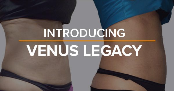 Introducing Venus Legacy